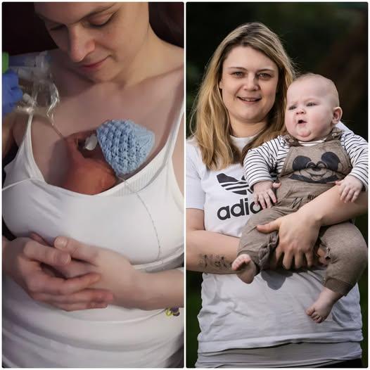 Oh My God! Miracle Baby Revived in Sandwich Bag After His Heart Stopped for 40 Minutes
