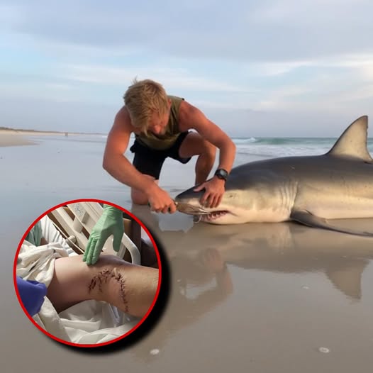 Man Hunts the Great White That Attacked Him — But What He Did After Catching It Shocked Everyone