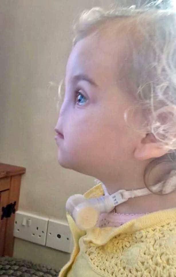 Girl Born Without Nose Nicknamed “Voldemort” Gives Bullies a Valuable Life Lesson