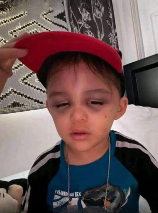 A 3-Year-Old Boy Was Found Safe After Being Missing for an Hour