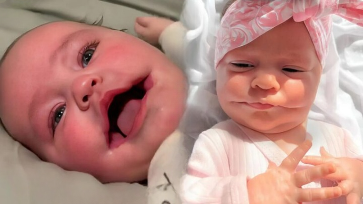 A Smile That Changed Everything: How One Baby’s Unusual Birth Brought Hope, Strength, and Inspiration to Thousands