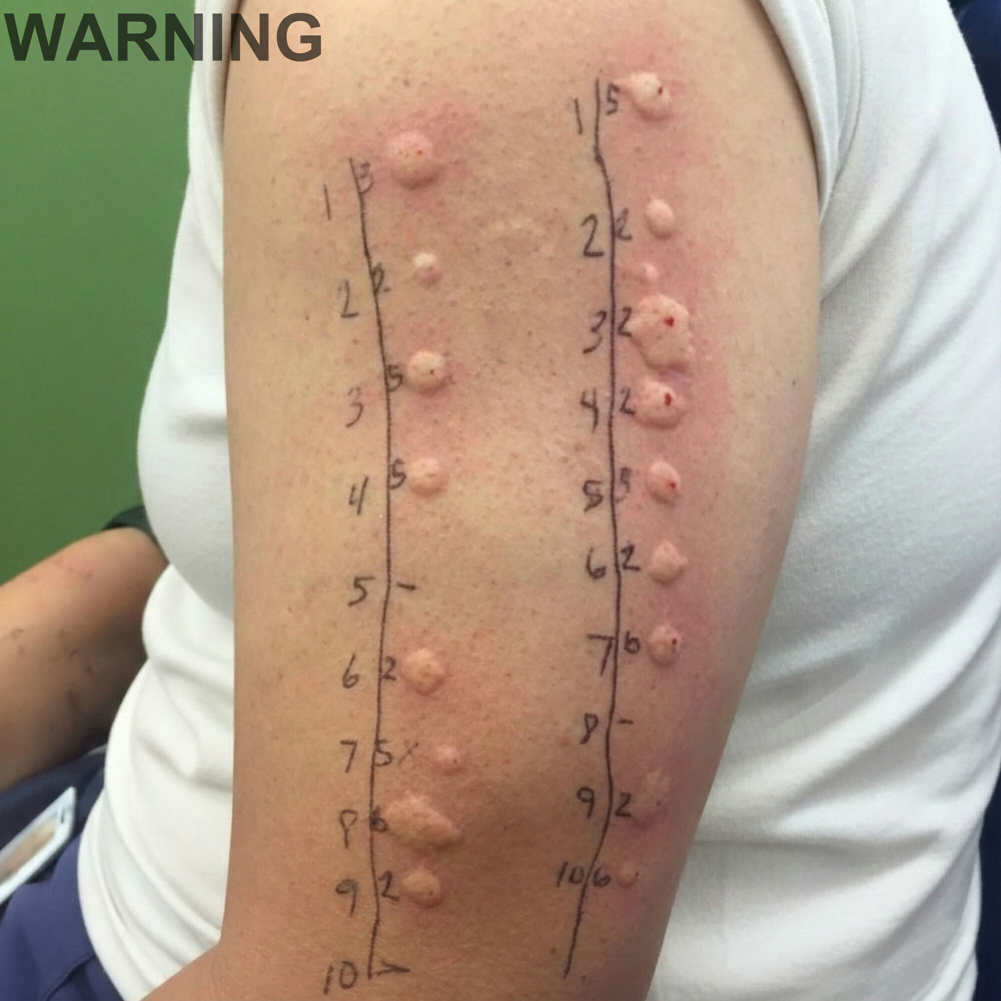 These are the consequences of sleeping with the…