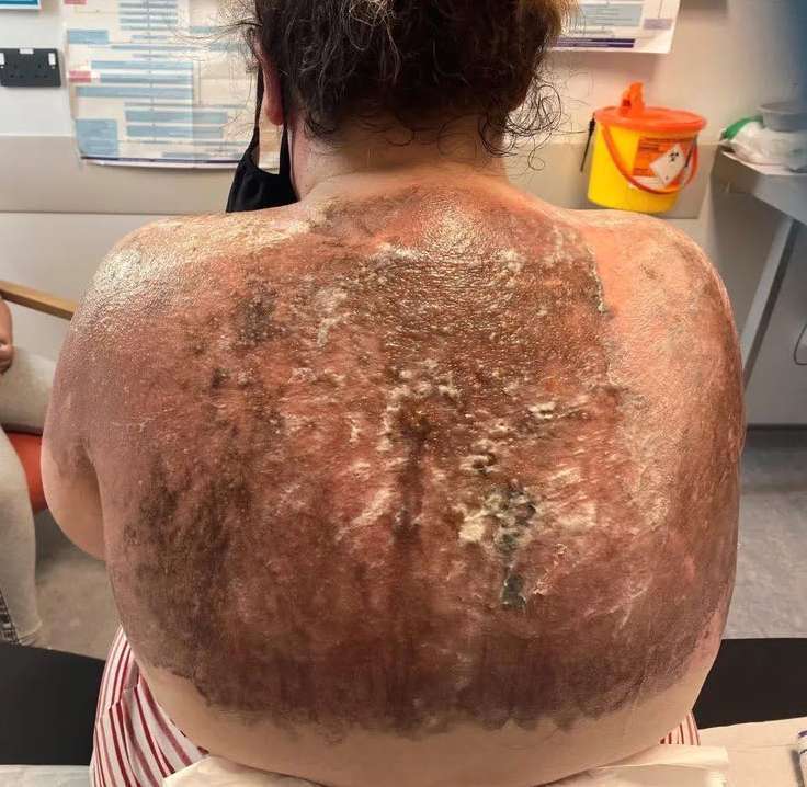 These are the consequences of sleeping with…