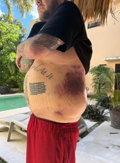 ‘Pawn Stars’ Corey Harrison issues plea to fans after near-death accident