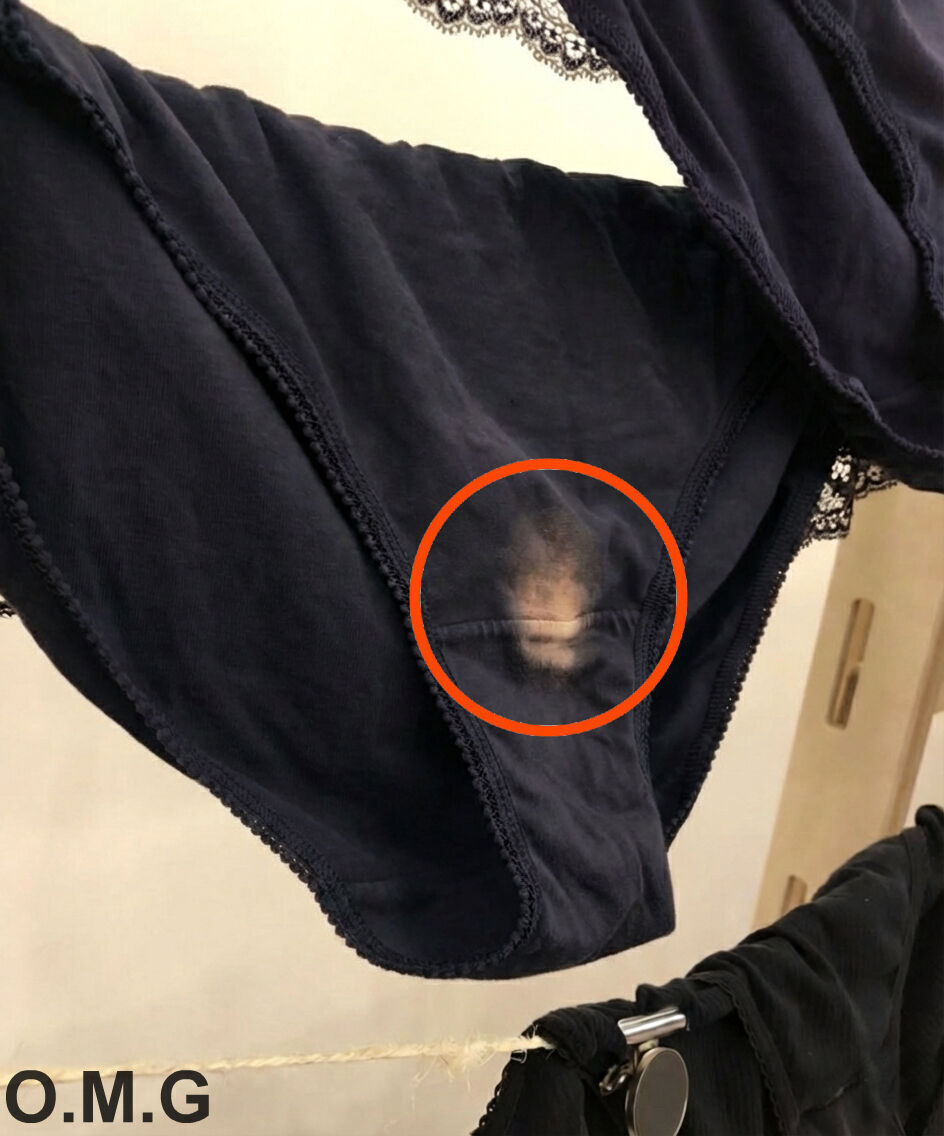 If You See A ‘Bleach’ Patch On Your Underwear, Here’s What It Means. See more