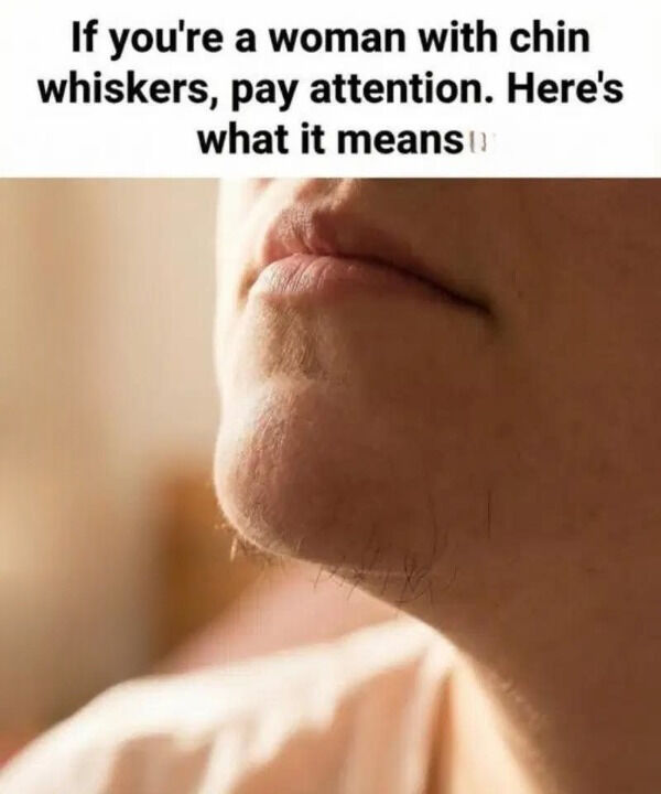 The Chin Hair Warning: What That One Stubborn Dark Hair Could Be Telling You About Your Hormones—and When It Actually Matters