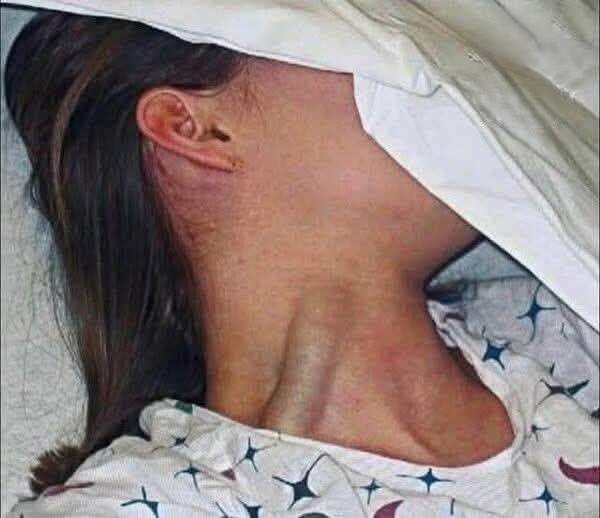 DEVASTATING LOSS: Young Woman’s Death Ignites Global Awareness About Overlooked Health Risks