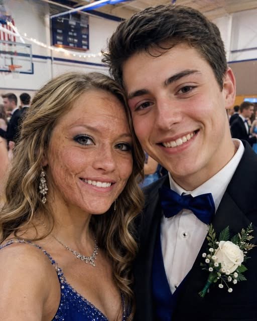 A Boy Asked Me to Be His Prom Date Because No One Else Would Look at Me After My Scars — The Next Morning, Police and His Parents Appeared at My Door